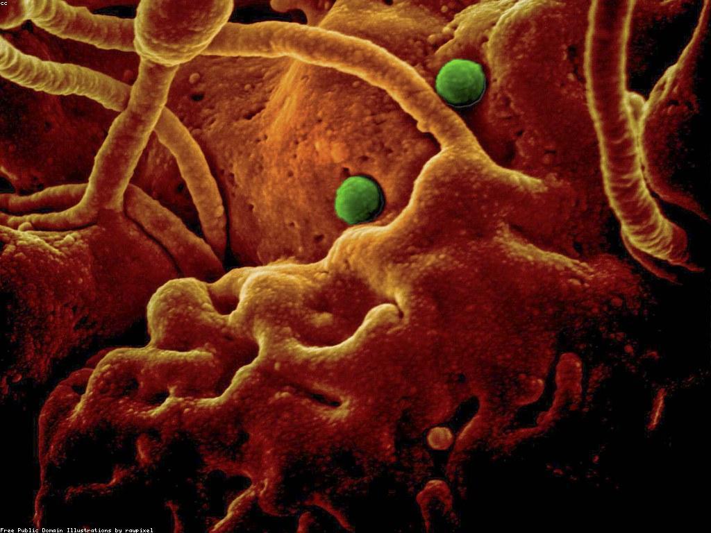 សារៈសំខាន់នៃការយល់ដឹងអំពីសុវត្ថិភាព