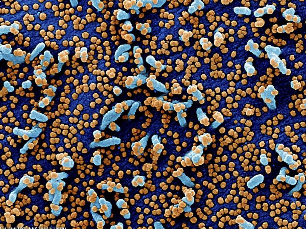 សារៈសំខាន់នៃការយល់ដឹងអំពីការពារសុវត្ថិភាព